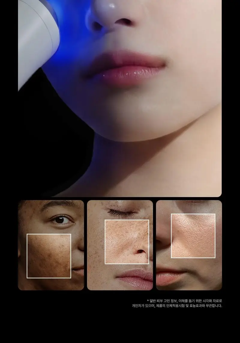 [서인영 디바이스, 모공 수, 모공부위 탄력개선, 300만 플라즈마 샷] 피캄 클리어 프로 상세페이지 26